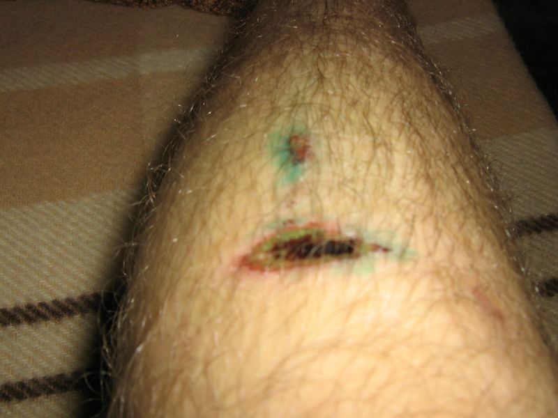 привыкал к новым ролликам