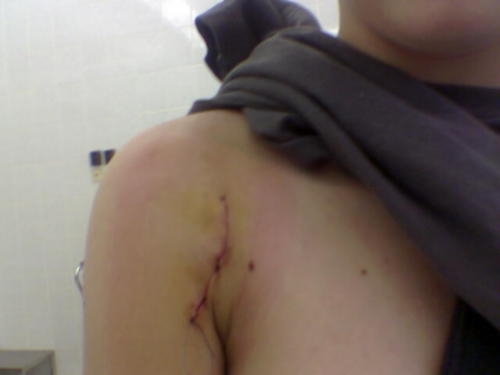 рампе-смерть!!!2 винта,2 жгута и 1 пластина!!!смерть рампам!!Стрит форэва