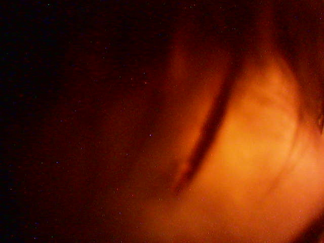 вот это Илюше так расхуярили лоб. пизда просто, а не лоб))))