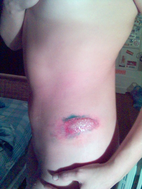 После аварии